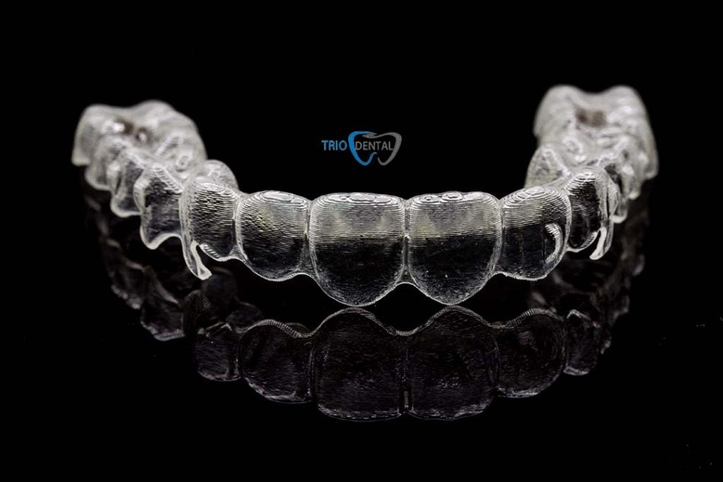 aligner 3 (1)