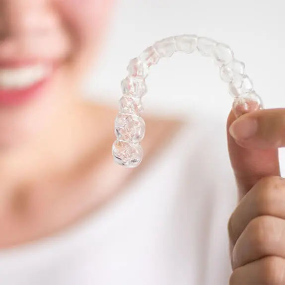 aligner-options.jpg (1)